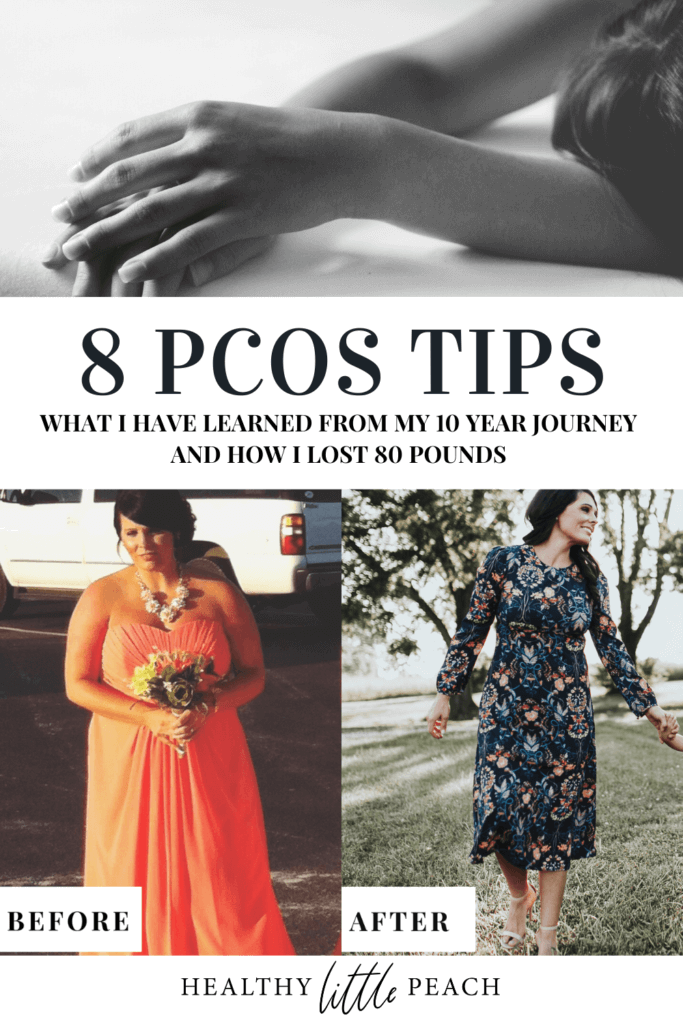 8 PCOS Tips